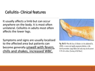 Cellulitis- Clinical features
It usually affects a limb but can occur
anywhere on the body. It is most often
unilateral. Cellulitis in adults most often
affects the lower legs.
Symptoms and signs are usually localised
to the affected area but patients can
become generally unwell with fevers,
chills and shakes, increased WBC.
3
3
 