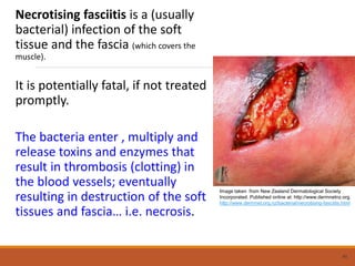 Necrotising fasciitis is a (usually
bacterial) infection of the soft
tissue and the fascia (which covers the
muscle).
It is potentially fatal, if not treated
promptly.
The bacteria enter , multiply and
release toxins and enzymes that
result in thrombosis (clotting) in
the blood vessels; eventually
resulting in destruction of the soft
tissues and fascia… i.e. necrosis.
45
Image taken from New Zealand Dermatological Society
Incorporated. Published online at: http://www.dermnetnz.org.
http://www.dermnet.org.nz/bacterial/necrotising-fasciitis.html
 