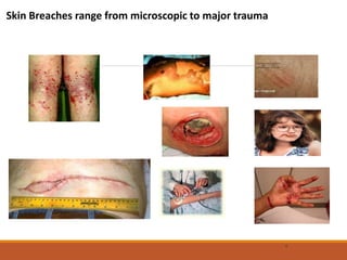 Skin Breaches range from microscopic to major trauma
6
 