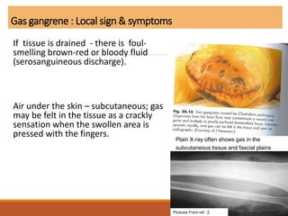 Gas gangrene : Local sign & symptoms
If tissue is drained - there is foul-
smelling brown-red or bloody fluid
(serosanguineous discharge).
Air under the skin – subcutaneous; gas
may be felt in the tissue as a crackly
sensation when the swollen area is
pressed with the fingers.
60
Plain X-ray often shows gas in the
subcutaneous tissue and fascial plains
Pictures From ref : 2
 