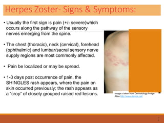 Herpes Zoster- Signs & Symptoms:
7
6
Image s taken from Dermatology Image
Atlas http://www.dermis.net/
• Usually the first sign is pain (+/- severe)which
occurs along the pathway of the sensory
nerves emerging from the spine.
• The chest (thoracic), neck (cervical), forehead
(ophthalmic) and lumbar/sacral sensory nerve
supply regions are most commonly affected.
• Pain be localized or may be spread.
• 1-3 days post occurrence of pain, the
SHINGLES rash appears, where the pain on
skin occurred previously; the rash appears as
a “crop” of closely grouped raised red lesions.
 