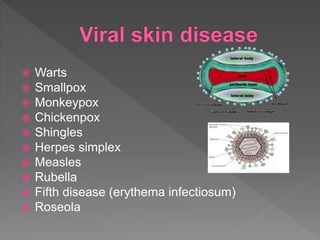  Warts
 Smallpox
 Monkeypox
 Chickenpox
 Shingles
 Herpes simplex
 Measles
 Rubella
 Fifth disease (erythema infectiosum)
 Roseola
 