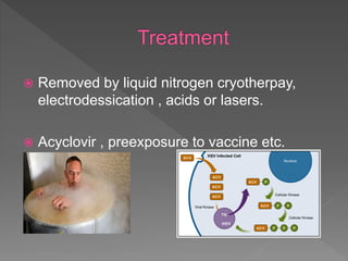  Removed by liquid nitrogen cryotherpay,
electrodessication , acids or lasers.
 Acyclovir , preexposure to vaccine etc.
 