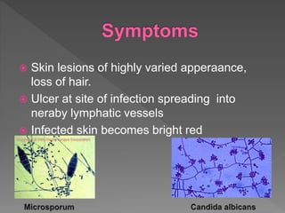  Skin lesions of highly varied apperaance,
loss of hair.
 Ulcer at site of infection spreading into
neraby lymphatic vessels
 Infected skin becomes bright red
 