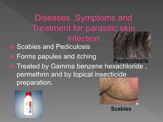  Scabies and Pediculosis
 Forms papules and itching
 Treated by Gamma benzene hexachloride ,
permethrin and by topical insecticide
preparation.
 
