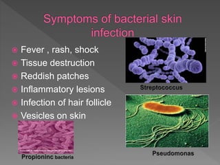  Fever , rash, shock
 Tissue destruction
 Reddish patches
 Inflammatory lesions
 Infection of hair follicle
 Vesicles on skin
 