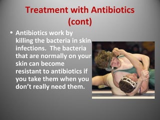 Treatment with Antibiotics 
(cont) 
• Antibiotics work by 
killing the bacteria in skin 
infections. The bacteria 
that are normally on your 
skin can become 
resistant to antibiotics if 
you take them when you 
don’t really need them. 
 