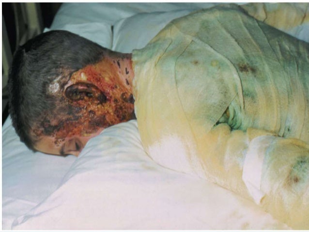 Skin infections
