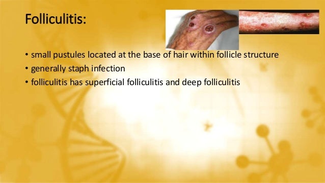 Skin Infections