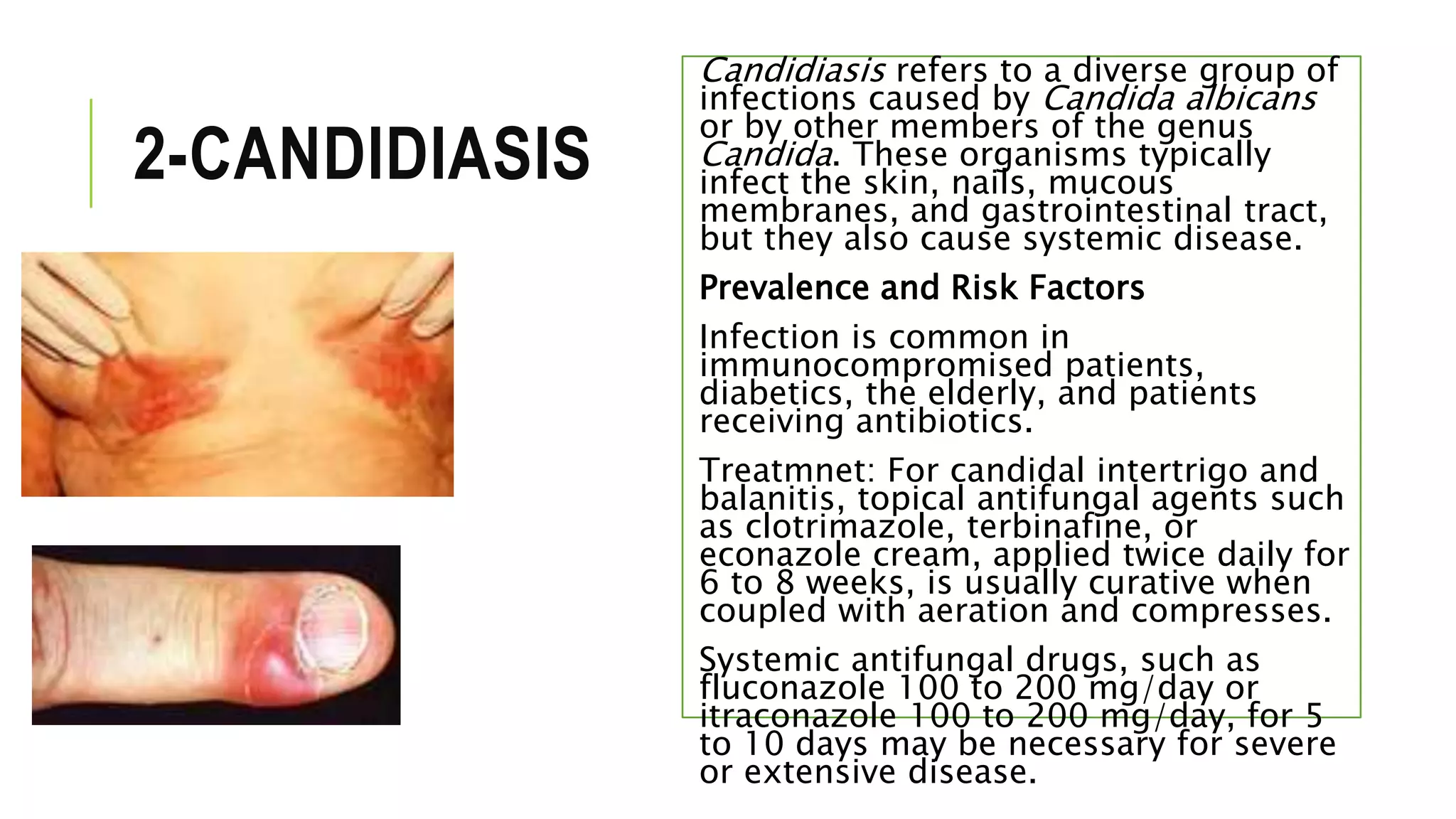 2-CANDIDIASIS
Candidiasis refers to a diverse group of
infections caused by Candida albicans
or by other members of the genus
Candida. These organisms typically
infect the skin, nails, mucous
membranes, and gastrointestinal tract,
but they also cause systemic disease.
Prevalence and Risk Factors
Infection is common in
immunocompromised patients,
diabetics, the elderly, and patients
receiving antibiotics.
Treatmnet: For candidal intertrigo and
balanitis, topical antifungal agents such
as clotrimazole, terbinafine, or
econazole cream, applied twice daily for
6 to 8 weeks, is usually curative when
coupled with aeration and compresses.
Systemic antifungal drugs, such as
fluconazole 100 to 200 mg/day or
itraconazole 100 to 200 mg/day, for 5
to 10 days may be necessary for severe
or extensive disease.
 