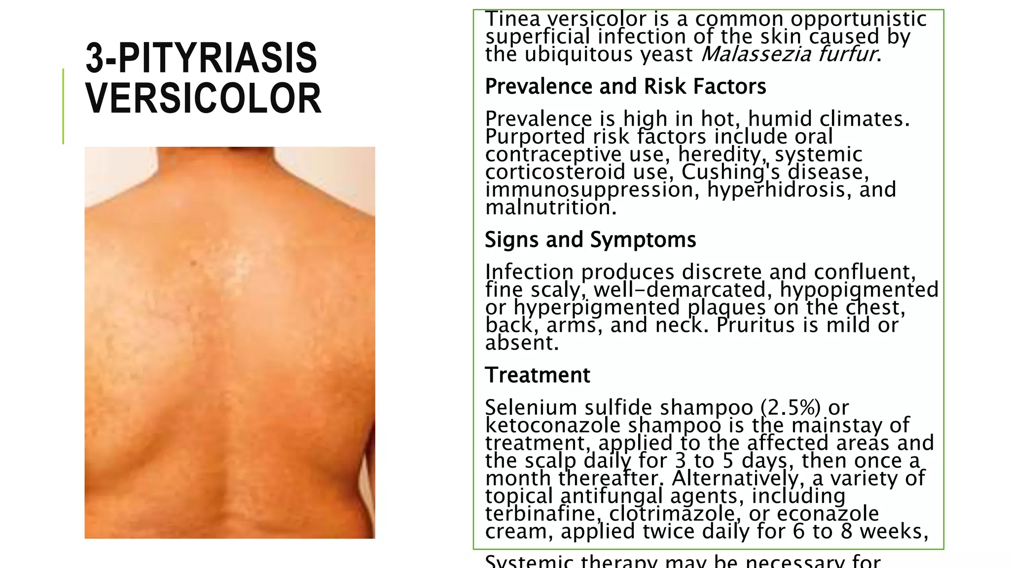 3-PITYRIASIS
VERSICOLOR
Tinea versicolor is a common opportunistic
superficial infection of the skin caused by
the ubiquitous yeast Malassezia furfur.
Prevalence and Risk Factors
Prevalence is high in hot, humid climates.
Purported risk factors include oral
contraceptive use, heredity, systemic
corticosteroid use, Cushing's disease,
immunosuppression, hyperhidrosis, and
malnutrition.
Signs and Symptoms
Infection produces discrete and confluent,
fine scaly, well-demarcated, hypopigmented
or hyperpigmented plaques on the chest,
back, arms, and neck. Pruritus is mild or
absent.
Treatment
Selenium sulfide shampoo (2.5%) or
ketoconazole shampoo is the mainstay of
treatment, applied to the affected areas and
the scalp daily for 3 to 5 days, then once a
month thereafter. Alternatively, a variety of
topical antifungal agents, including
terbinafine, clotrimazole, or econazole
cream, applied twice daily for 6 to 8 weeks,
 