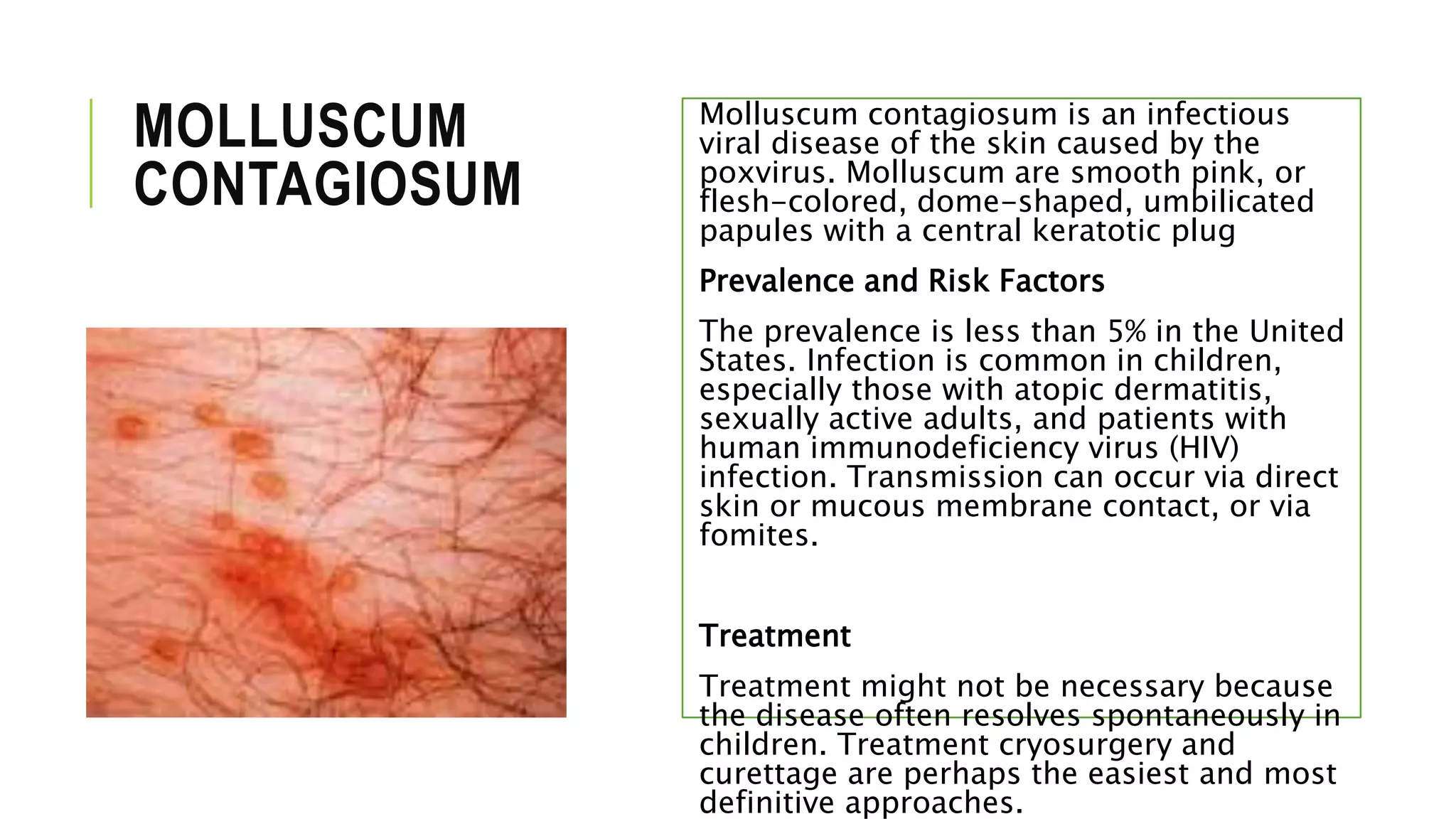 MOLLUSCUM
CONTAGIOSUM
Molluscum contagiosum is an infectious
viral disease of the skin caused by the
poxvirus. Molluscum are smooth pink, or
flesh-colored, dome-shaped, umbilicated
papules with a central keratotic plug
Prevalence and Risk Factors
The prevalence is less than 5% in the United
States. Infection is common in children,
especially those with atopic dermatitis,
sexually active adults, and patients with
human immunodeficiency virus (HIV)
infection. Transmission can occur via direct
skin or mucous membrane contact, or via
fomites.
Treatment
Treatment might not be necessary because
the disease often resolves spontaneously in
children. Treatment cryosurgery and
curettage are perhaps the easiest and most
definitive approaches.
 