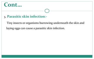 Skin infections | PPTX