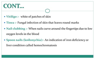 CONT…
 Vitiligo :- white of patches of skin
 Tinea :- Fungal infection of skin that leaves round marks
 Nail clubbing :...