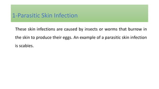 These skin infections are caused by insects or worms that burrow in
the skin to produce their eggs. An example of a parasitic skin infection
is scabies.
1-Parasitic Skin Infection
 