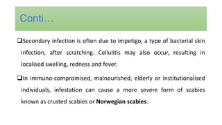 Secondary infection is often due to impetigo, a type of bacterial skin
infection, after scratching. Cellulitis may also occur, resulting in
localised swelling, redness and fever.
In immuno-compromised, malnourished, elderly or institutionalised
individuals, infestation can cause a more severe form of scabies
known as crusted scabies or Norwegian scabies.
Conti…
 