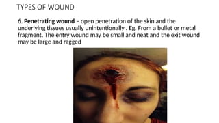 TYPES OF WOUND
6. Penetrating wound – open penetration of the skin and the
underlying tissues usually unintentionally . Eg. From a bullet or metal
fragment. The entry wound may be small and neat and the exit wound
may be large and ragged
 