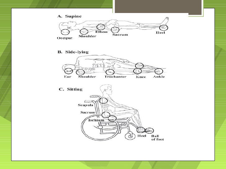 Skin integrity and Wound Care
