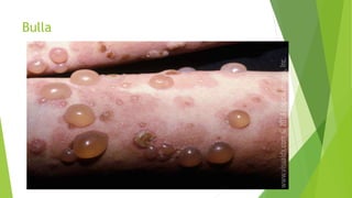 Skin lesion Dr. Mumux | PPTX
