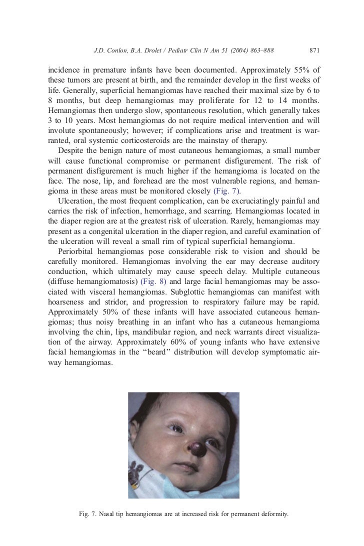 skin xanthogranuloma treatment in neonate Skin lesion