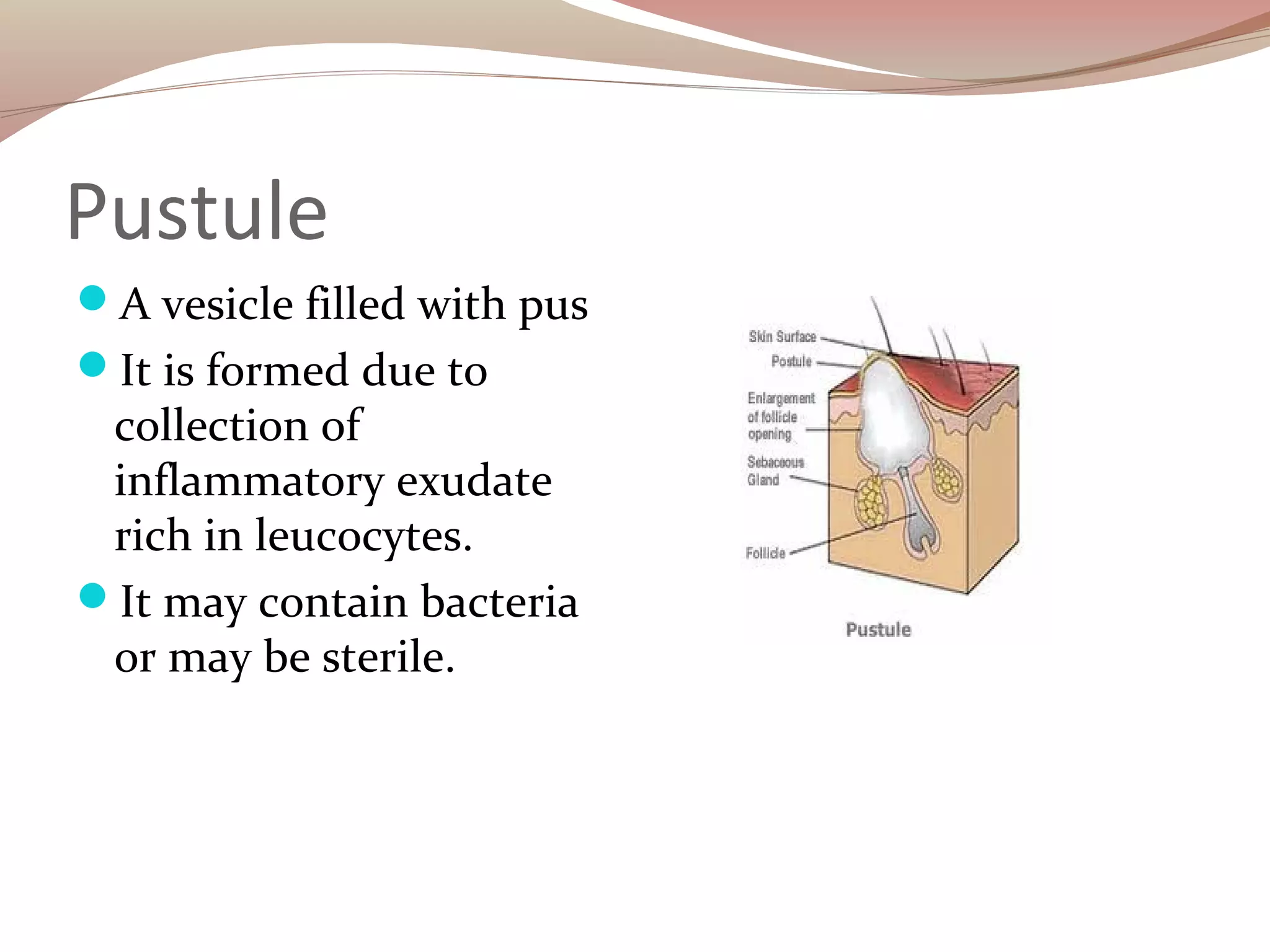 Skin lesions | PPT