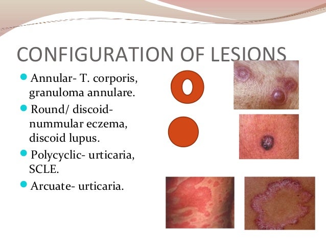 skin lesions skin lesions, Skeleton