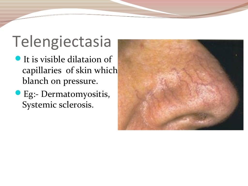 Skin lesions