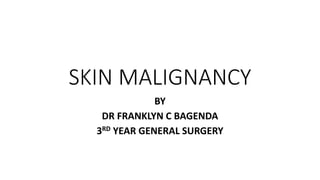 SKIN MALIGNANCY
BY
DR FRANKLYN C BAGENDA
3RD YEAR GENERAL SURGERY
 