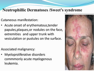 Skin manifestation of internal malignancy | PPTX