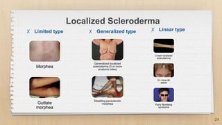 Scleroderma Types Chart Skin manifestations in rheumatic diseases | PPTX