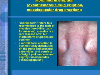 Morbiliform Rash Diffuse Skin Manifestations Of Systemic Diseases | PPT