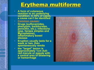 Skin Manifestations Of Systemic Diseases | PPT