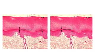 The microscopic features of the skin and its appendages | PPTX