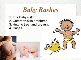Baby Rashes 
1. The baby's skin 
2. Common skin problems 
3. How to treat and prevent 
4. Cases 
 