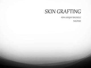 SKIN GRAFTING
-RIYA SANJAY BAGHELE
NAGPUR
 