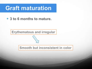  3 to 6 months to mature.
Graft maturation
Smooth but inconsistent in color
Erythematous and irregular
 