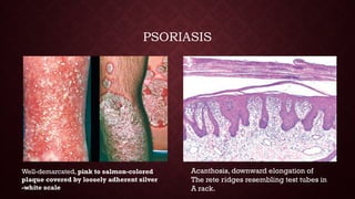 Skin pathology ( dermatological lesions) | PPTX