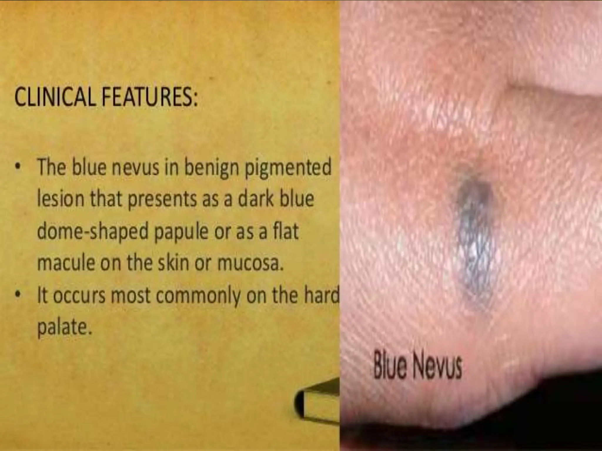 Pathology of the skin skin pathology skin | PPTX