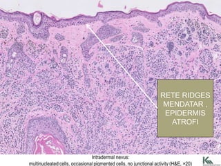 Rete Ridges Structure Pathology of the skin skin pathology skin | PPTX