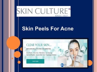 Skin Peels For Acne
 