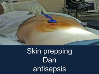 Skin prepping
Dan
antisepsis
 