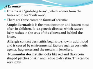 2) Eczema-
 Eczema is a “grab-bag term” , which comes from the
Greek word for “boils over”.
 There are three common forms of eczema:
Atopic dermatitis is the most common and is seen most
often in children. It is a genetic disease, which causes
itchy rashes in the crux of the elbows and behind the
knees.
Allergic contact dermatitis begins to show in adulthood
and is caused by environmental factors such as cosmetic
agents, fragrances and the metals in jewellery.
Nummular dermatitis looks like red and flaky coin
shaped patches of skin and is due to dry skin. This can be
very itchy.
 