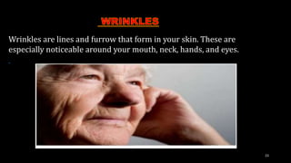 Skin problems | PPTX