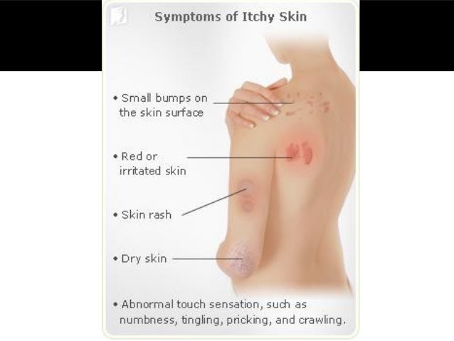 a rash of rashes alerting clothing customers to potential skin irritation a rash of rashes alerting clothing customers to potential skin irritation