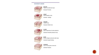 Rash Approach Algorithm Approach to Skin rash | PPTX