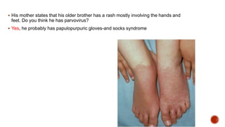 Wool Sock Rash Approach to Skin rash | PPTX