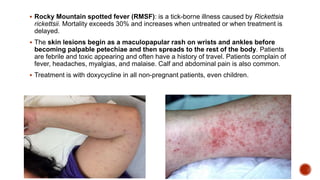 Rms Rash Approach to Skin rash | PPTX