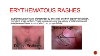 Approach to Skin rash | PPTX