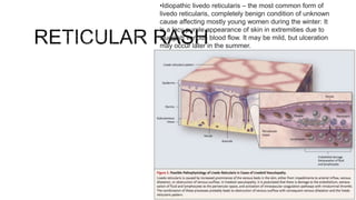 Approach to Skin rash | PPTX