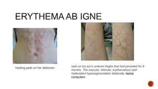 Rash Recticular Approach to Skin rash | PPTX
